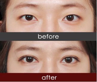 四川美容整形機構(gòu)哪家好？全方位評比四川最佳美容整形機構(gòu)排行榜