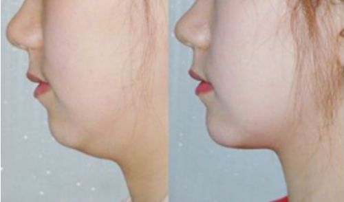 山東臨沂整容醫(yī)院排行榜及綜合評價(jià)：哪家好？