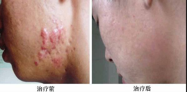 合肥哪家整容醫(yī)院雙眼皮做得好？專業(yè)整形外科專家推薦