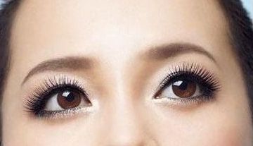 成都嬌點王運(yùn)平隆胸效果如何？真實案例分享！