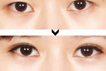 寧夏整形醫(yī)院哪家好？綜合評測，推薦您最滿意的整形醫(yī)院