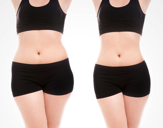 2023廣州頸紋填充嗨體正規(guī)醫(yī)生口碑(王志軍、伍明政、李翠華全新實(shí)力曝光)