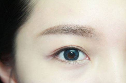 寧波哪家醫(yī)院割雙眼皮效果好？