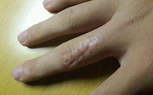 上海哪家醫(yī)院做肋骨鼻子整形手術(shù)好？