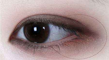 2023濟(jì)南5s重瞼術(shù)權(quán)威醫(yī)生口碑TOP10(于杰、張義晨、王標(biāo)多方面出擊入圍榜單)