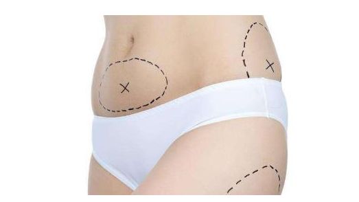 上海哪家醫(yī)院的祛眼袋手術(shù)效果最好？讓您的眼睛重獲明亮與青春