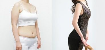 成都做雙眼皮，哪家醫(yī)院專業(yè)可靠？