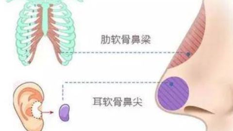 廣州有哪些醫(yī)院可以進(jìn)行抽脂手術(shù)？