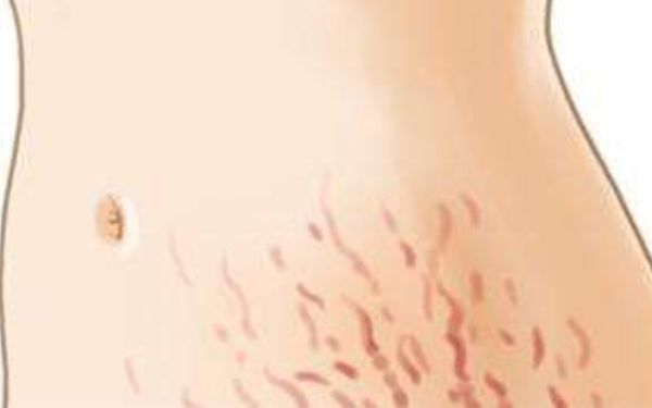 新鄉(xiāng)海迪醫(yī)療整形美容醫(yī)院值得信賴嗎？2023年價(jià)格表與醫(yī)生信息一覽