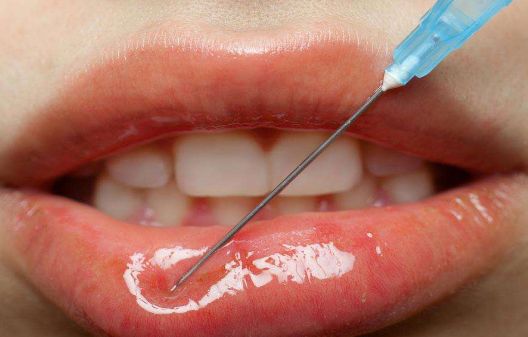 南京鼻梁塌醫(yī)院哪家好？南京鼻梁塌矯正醫(yī)院排名及選擇技巧分析