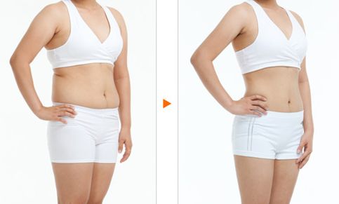 西安除疤效果最好的醫(yī)院排名及口碑調(diào)查