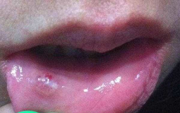 2023成都木偶紋填充注射專家排行榜前幾(袁旭東、李清明、呂婧價(jià)格親民)