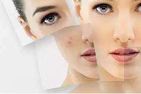 上海哪家醫(yī)院祛太田痣效果最佳？