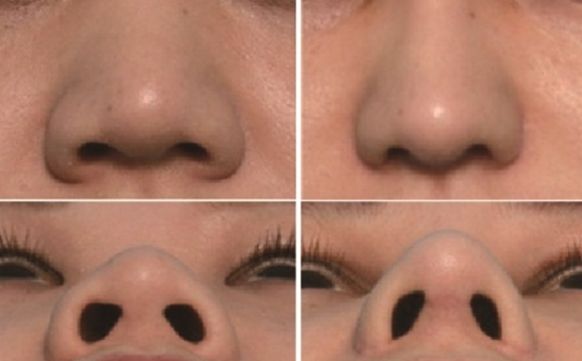 湖州市哪家醫(yī)院去疤痕好？專家推薦疤痕修復(fù)技術(shù)排行榜！