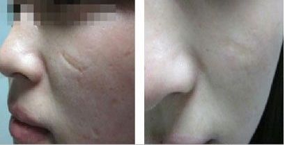 湖北棗陽整形醫(yī)院哪家最值得信賴？