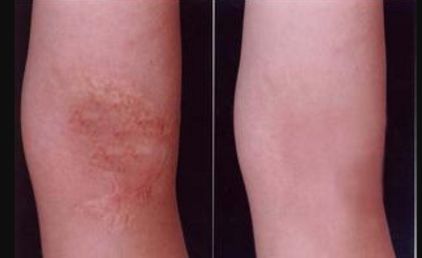 重慶整形醫(yī)院哪家效果好？權(quán)威排行榜來(lái)告訴你！