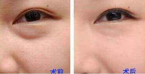 杭州整形美容界大咖PK，曾海峰、河東鎬、高俊明，想知道磨骨哪個醫(yī)生靠譜？