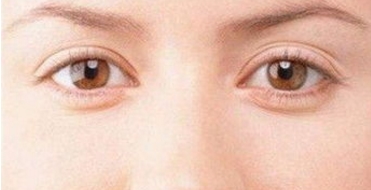 國內(nèi)哪些醫(yī)生在脂肪填充領(lǐng)域躋身專家級別？張懷軍、顧云鵬、王自謙等名醫(yī)榜上有名！