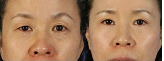 南京硅膠隆鼻哪家醫(yī)院好？斯景醫(yī)療專家推薦！