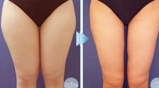 哪位醫(yī)生在北京八大處做拉皮手術(shù)效果好？馬繼光的資歷和費(fèi)用情況有哪些？