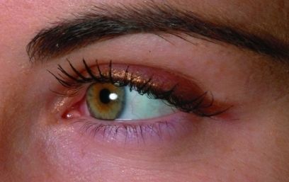 上海哪家醫(yī)院治療疤痕效果好？上海三甲疤痕醫(yī)院哪家最受歡迎？