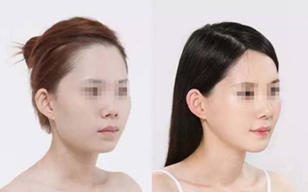 北京隆胸醫(yī)生排行：網(wǎng)友推薦的實(shí)力派、口碑出眾的美容專家值得關(guān)注