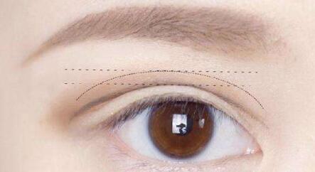 杭州劉軍鼻子塑形效果如何？個(gè)人簡介、醫(yī)院、費(fèi)用詳情先給您解答