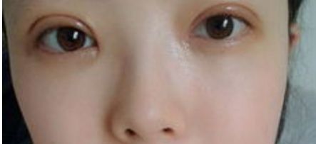 重慶隆鼻整形排名前三的醫(yī)院有哪些？