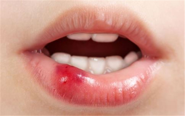 2023成都Liposuction360°水動力吸脂醫(yī)生在榜名單前十名(張?zhí)煲?、車尚勉、曾春梅都是實力?