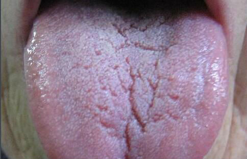 2023深圳磨顴骨術(shù)正規(guī)醫(yī)生前10強(馬愛紅、曹思佳、沈洪波榜上有名！)