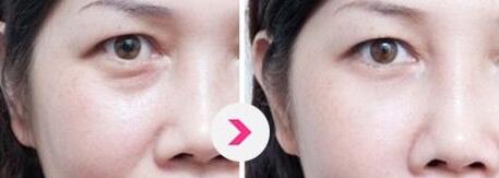 上海知名眼部整形專家出爐！2023年度指定眼王整形專家名單公布，附價格表參考！