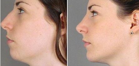 上?？簇惪损肽募裔t(yī)院好？選個靠譜的！