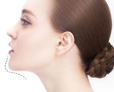 2023長(zhǎng)沙玻尿酸填充眼角紋正規(guī)醫(yī)生10強(qiáng)(楊興華、張瓊、舒艷強(qiáng)烈推薦！)