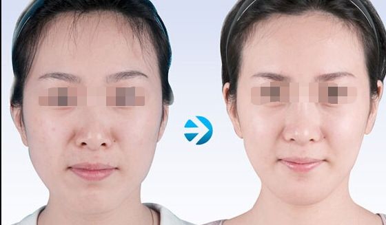 蘇州哪家吸脂好又實惠？專業(yè)美容機構(gòu)為您推薦