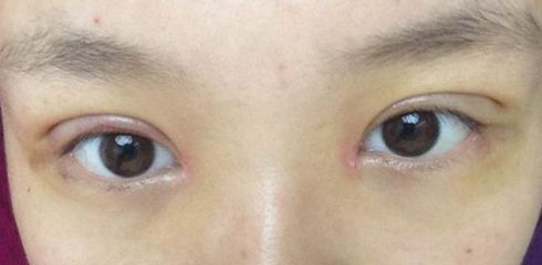 徐州做拉皮哪家醫(yī)院好？一起來看看徐州市最受歡迎的做拉皮醫(yī)院