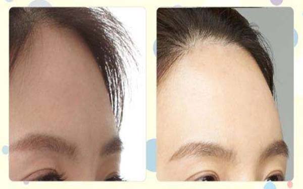 全國整容醫(yī)生PHD公開名單，創(chuàng)新技術(shù)行業(yè)新標桿