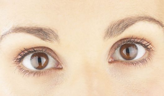 南寧哪家祛痘的醫(yī)院好？找到最適合您的祛痘專家！