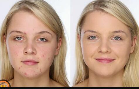 上海比較好的雙眼皮醫(yī)生排行榜揭曉！徐劍煒、劉天一、李斌等名字在列