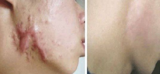 海口市整形醫(yī)院哪家好？專家推薦最具口碑的?？谡吾t(yī)院有哪些？