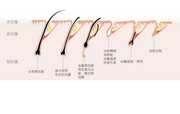 深圳哪家激光祛斑醫(yī)院口碑好？