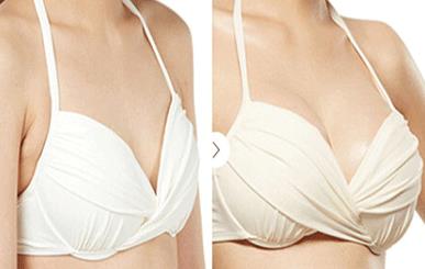 2023重慶冷凍法去黃褐斑強(qiáng)榜前十強(qiáng)的醫(yī)生(邵雅娟、吳細(xì)輕、劉玉婷評價(jià)一致贊美)