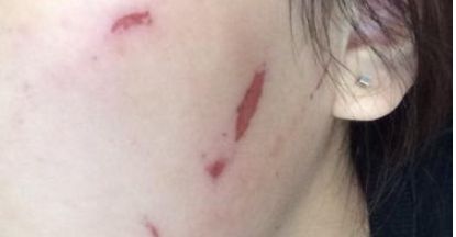 石家莊雅芳亞醫(yī)療美容醫(yī)院的醫(yī)院簡(jiǎn)介及醫(yī)生資料是什么？