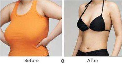 深圳雙眼皮修復(fù)哪家好？機(jī)構(gòu)排名及評(píng)價(jià)調(diào)查報(bào)告