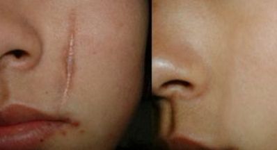 蘭州眼部修復手術哪家好？眼部整形專家為您推薦最佳選擇！