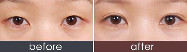 西安哪家美容醫(yī)院口碑好，專業(yè)評測推薦？