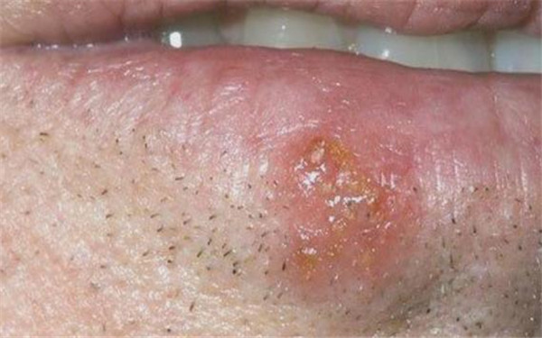 2023新疆水光針祛除唇紋醫(yī)生排行榜前十強(張傳功、李朝陽、張偉詳細資料)