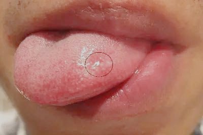 2023濮陽激光去細(xì)紋專家口碑前十位(張鵬、石付強(qiáng)、孔利靜口碑特色有不同)