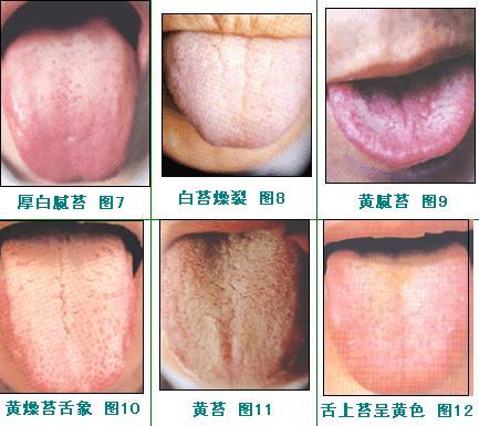 2023蘭州玻尿酸填充法令紋前10強(qiáng)醫(yī)生排名榜(張曉萍、張莉、雷虎正規(guī)資質(zhì)，口碑實(shí)力機(jī)構(gòu)，一鍵直達(dá)！)