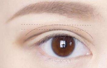 2023昆明眼睛細(xì)紋凹陷填充專家前10位上榜清單(黃柴永、劉瑋、崔亞萍值得選擇！)