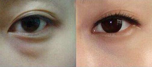 上海更受推薦的隆胸專家排行榜！王濤、江華等5位魅力無(wú)限，非?？孔V！